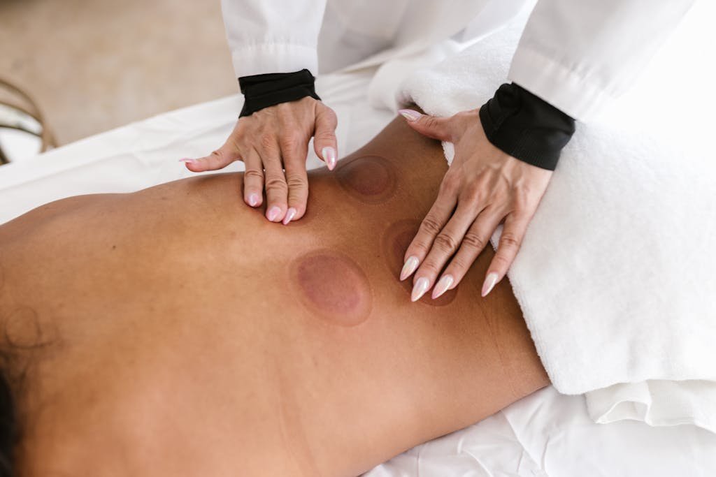 Close-up of a therapist performing cupping therapy on a back, promoting wellness.